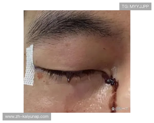 俱乐部晒出球员康复前后对比照，恢复效果惊人